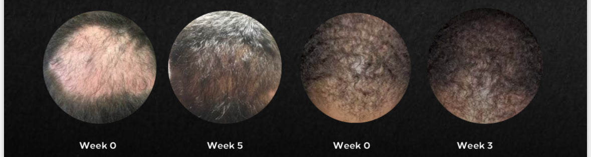 XTC Boost+ System w/Growth Factor+