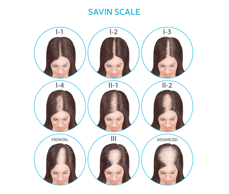 Kooswalla Hair Regrowth Complex